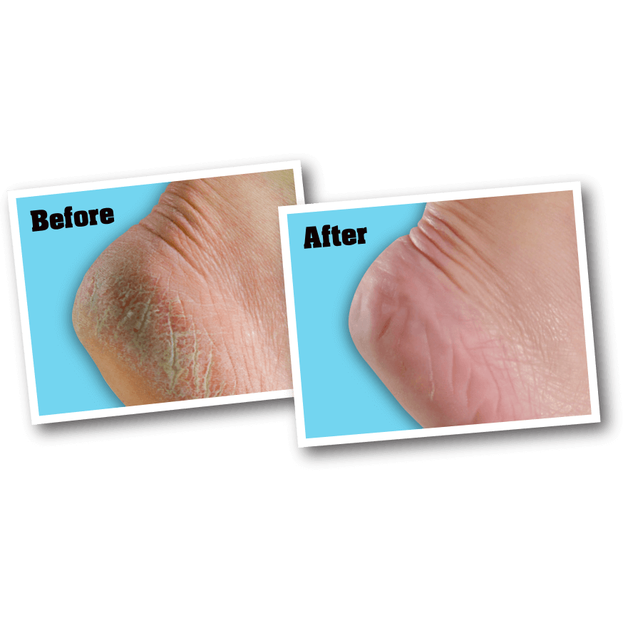 O’Keeffe’s for Healthy Feet Foot Cream - worknwear.ca